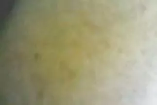 कैंसर के बारे में होम वीडियो सनी लियोन की सेक्सी मूवी दिखाओ